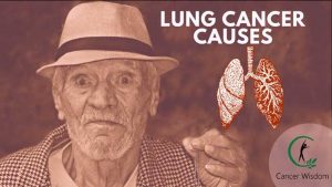lung cancer causes